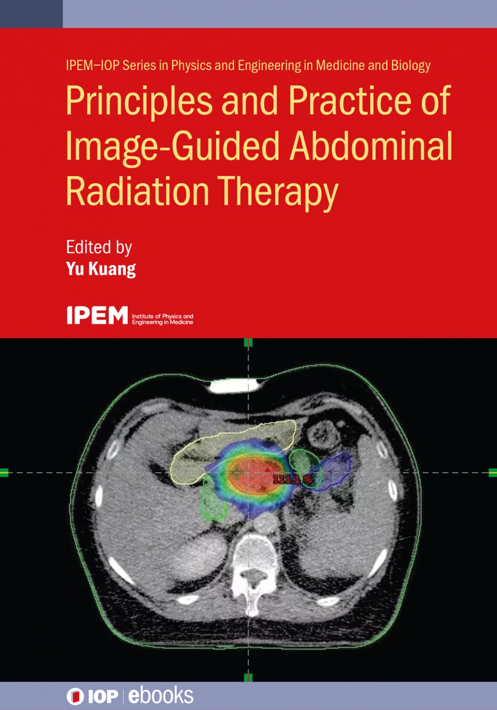 Cover of Principles and Practice of Image-Guided Abdominal Radiation Therapy