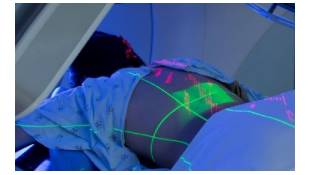 Barely ‘adequate’ staffing of radiotherapy centres, says new report