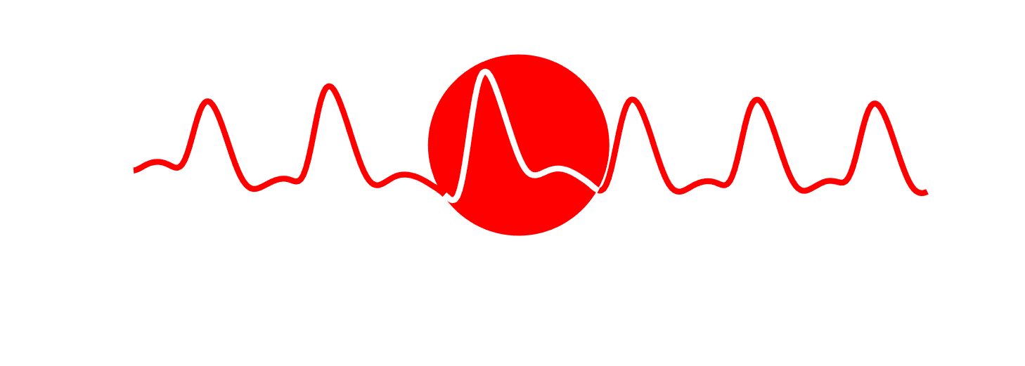 Photoplethysmography Signal Processing