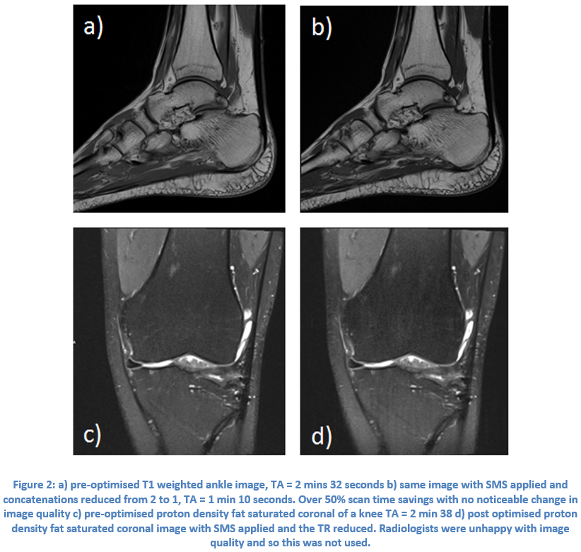 Case Study 1: Multi-Slice in Musculo-Skeletal MR on Siemens Sola (XA31)