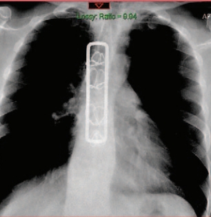 Rad Magazine Publication