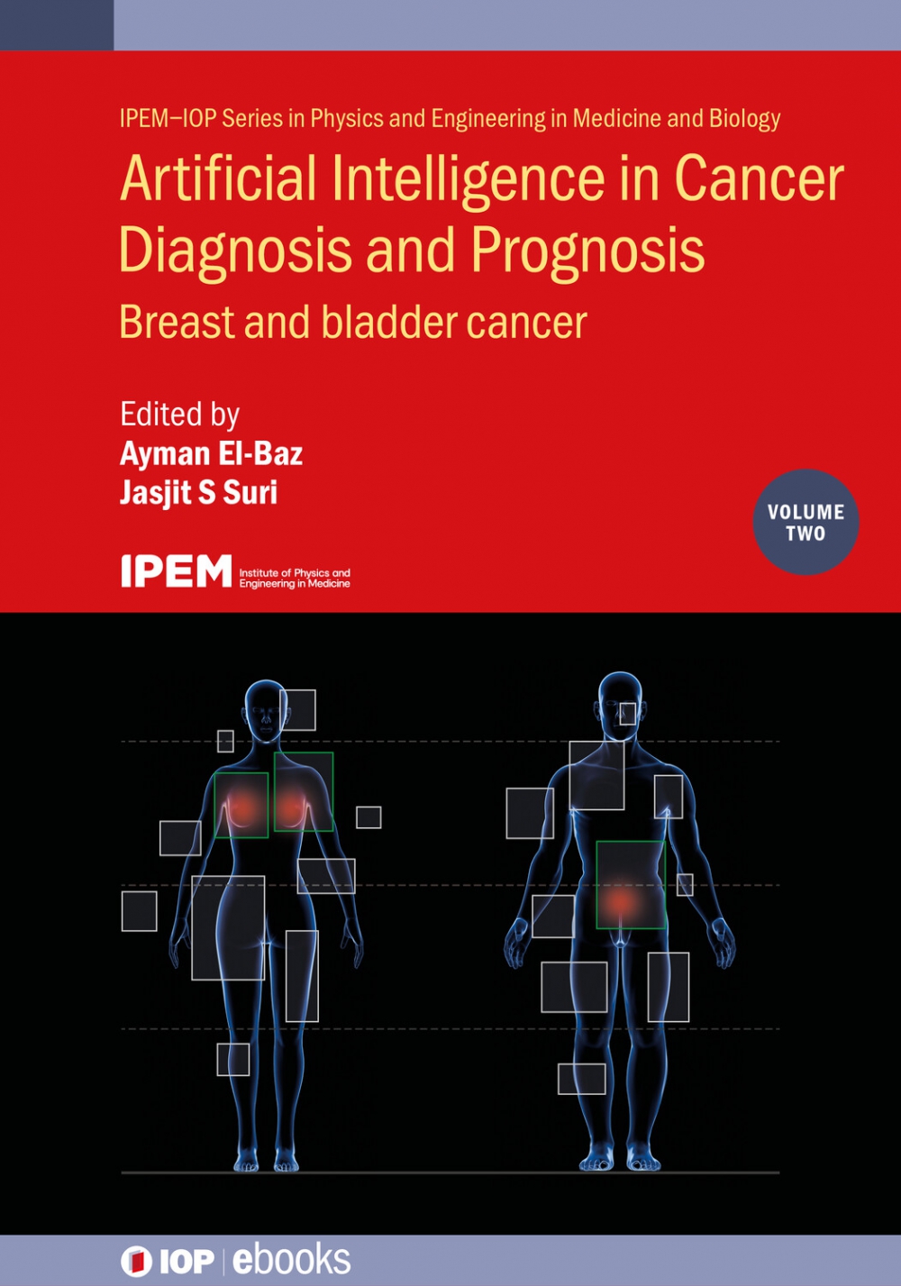 Cover of Artificial Intelligence in Cancer Diagnosis and Prognosis, Volume 2: Breast and Bladder Cancer