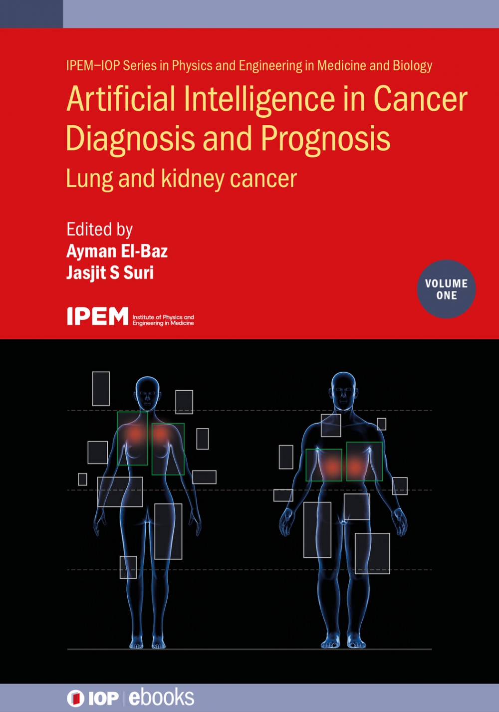 Cover of Artificial Intelligence in Cancer Diagnosis and Prognosis, Volume 1: Lung and Kidney Cancer