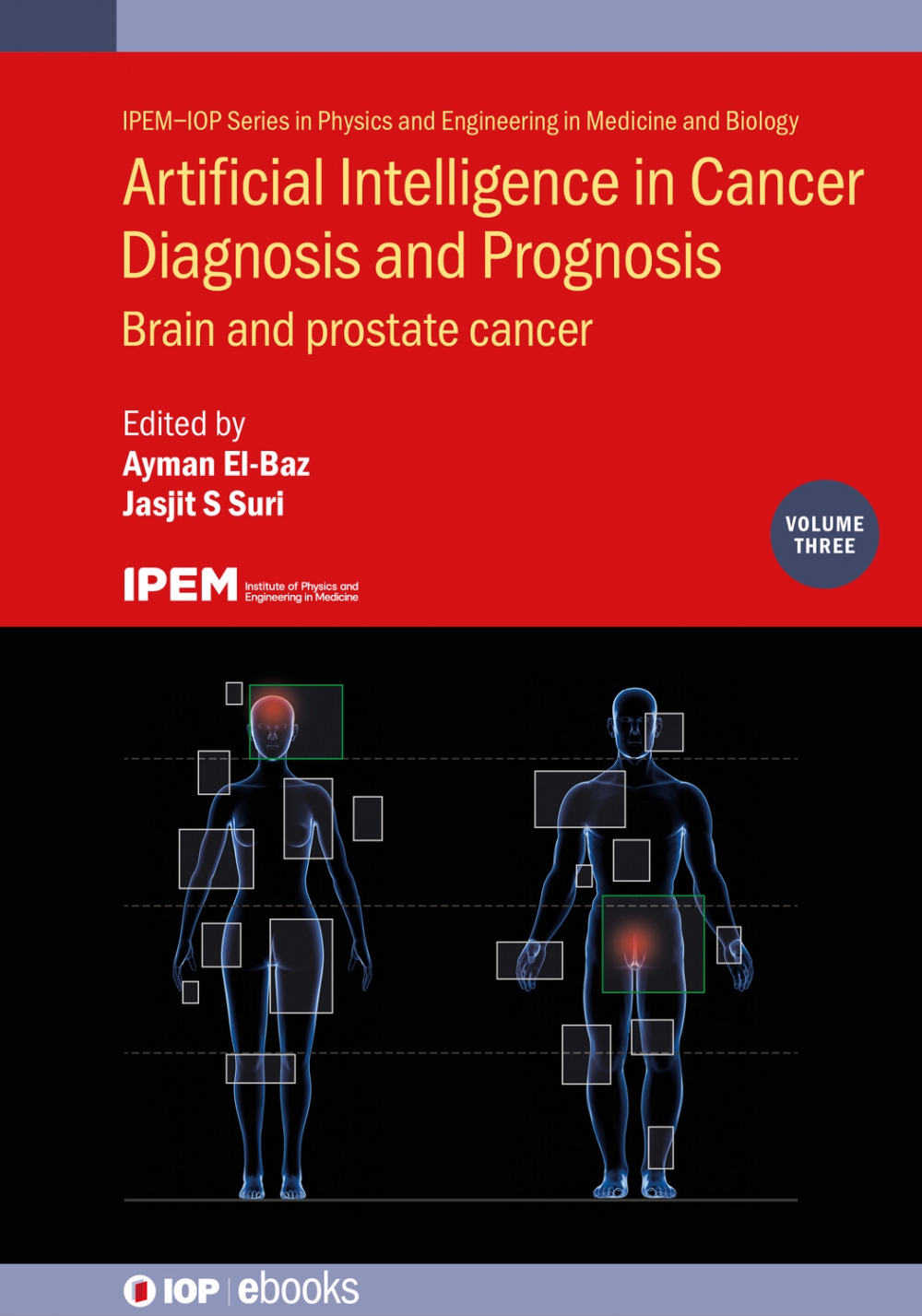 Cover of Artificial Intelligence in Cancer Diagnosis and Prognosis, Volume 3: Brain and Prostate Cancer