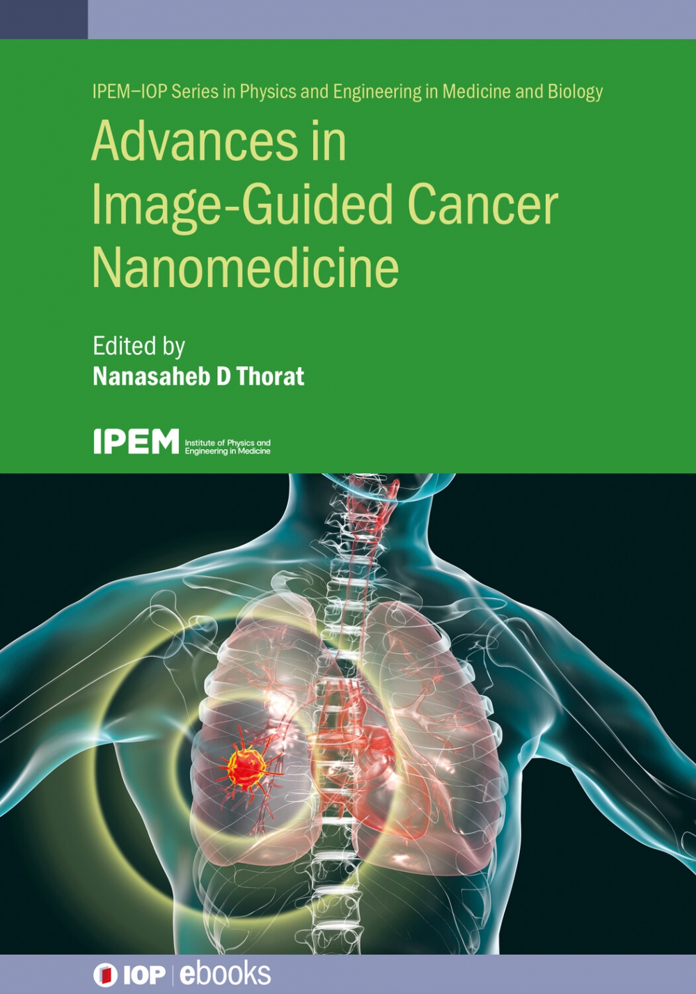 Cover of Advances in Image Guided Cancer Nanomedicine
