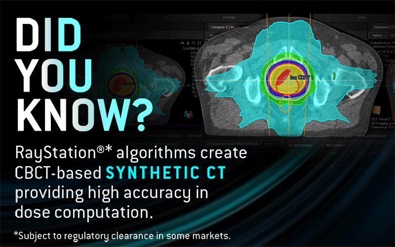 Synthetic CT Generation In RayStation